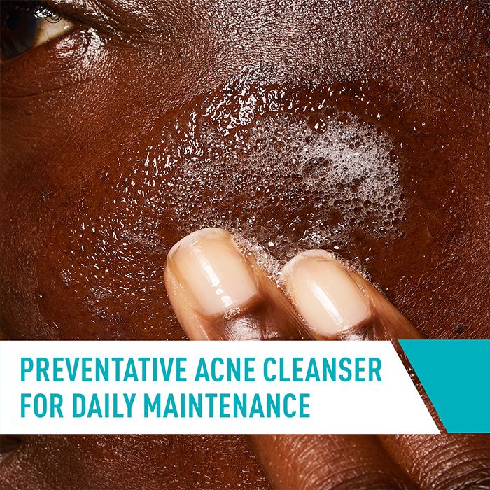 Acne Cleanser Texture